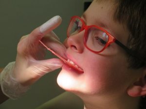 children with special needs braces
