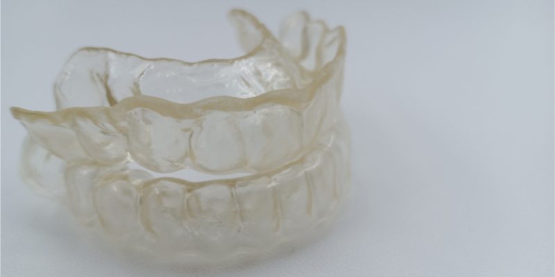 underbite surgery-dental cast