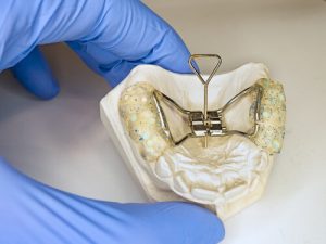child's palate expander