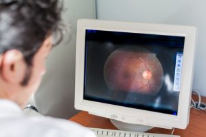 lenticular astigmatism light sensitivity