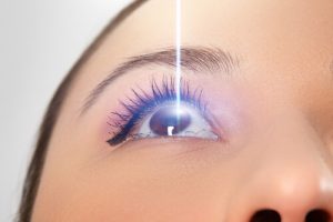 cataract surgery
